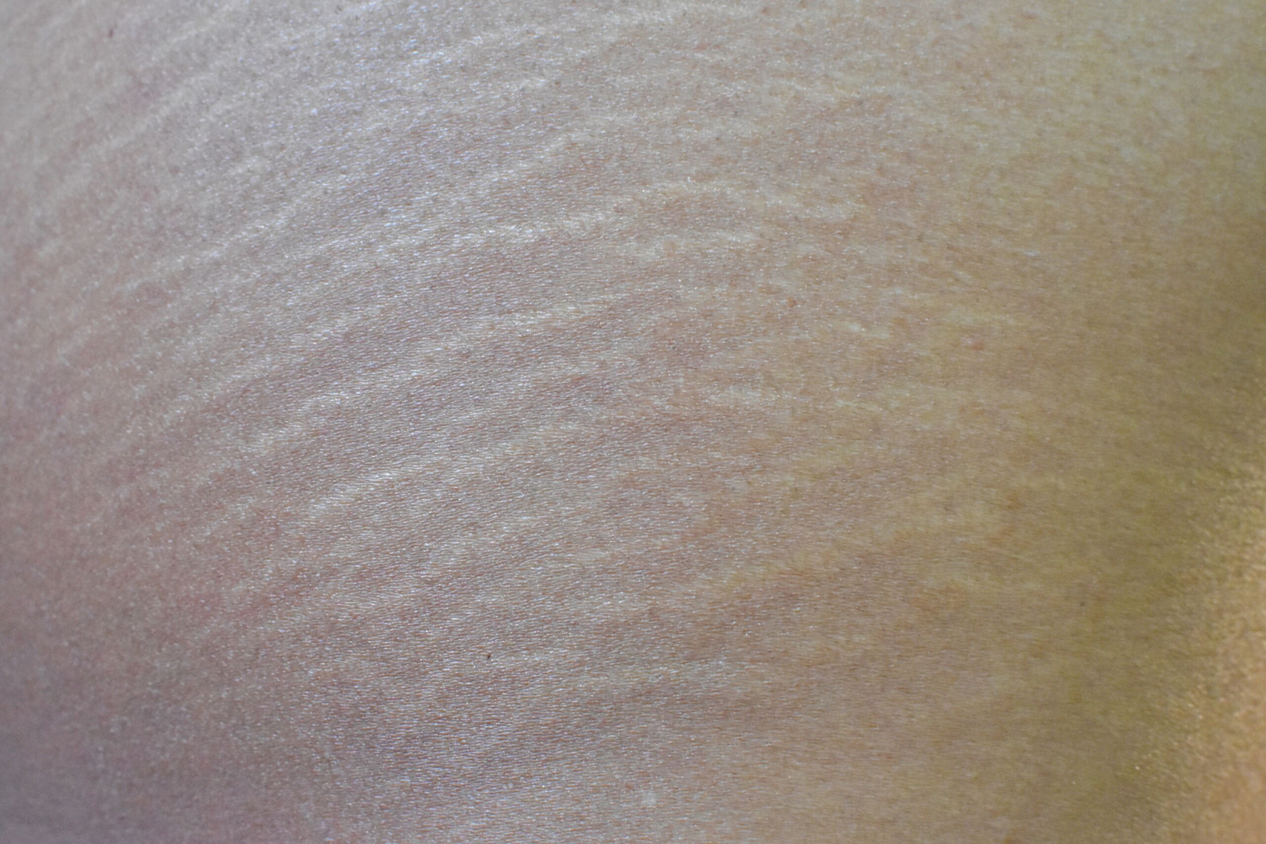 Fade Stretch Marks with Rosehip Oil